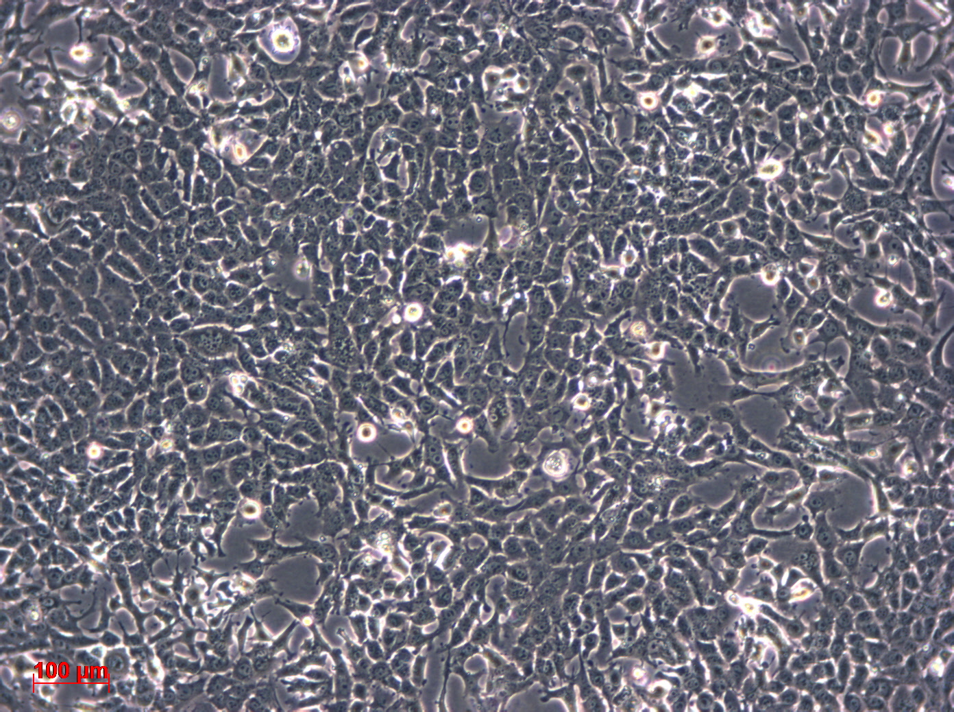 Hepa 1-6细胞图片